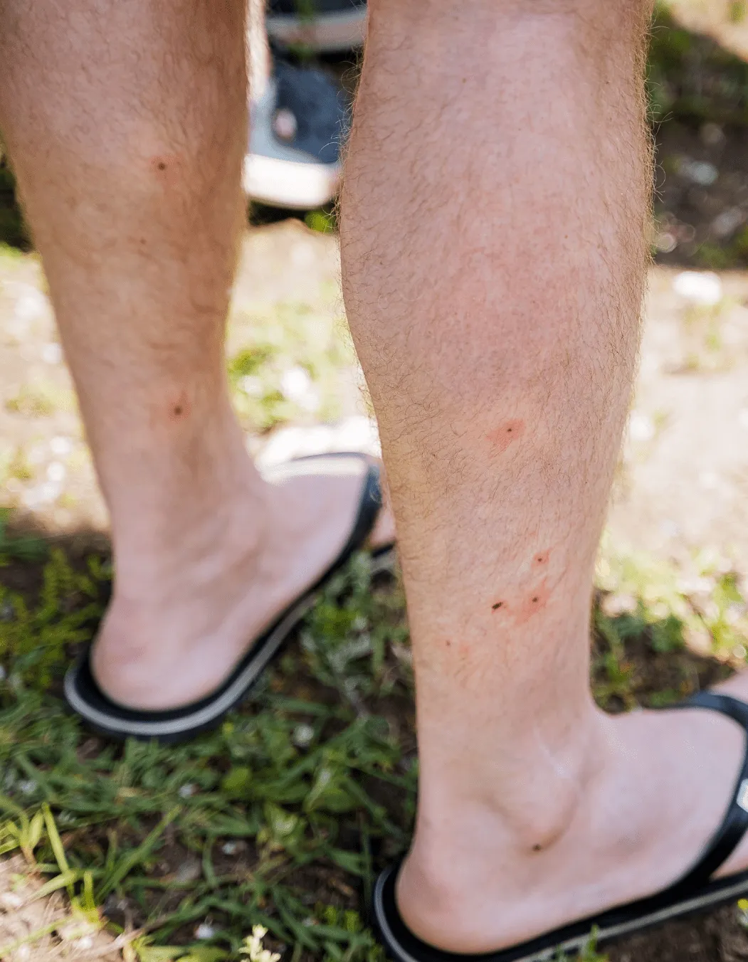 Those Invisible Itches: Tackling Tampa Bay's No-See-Ums